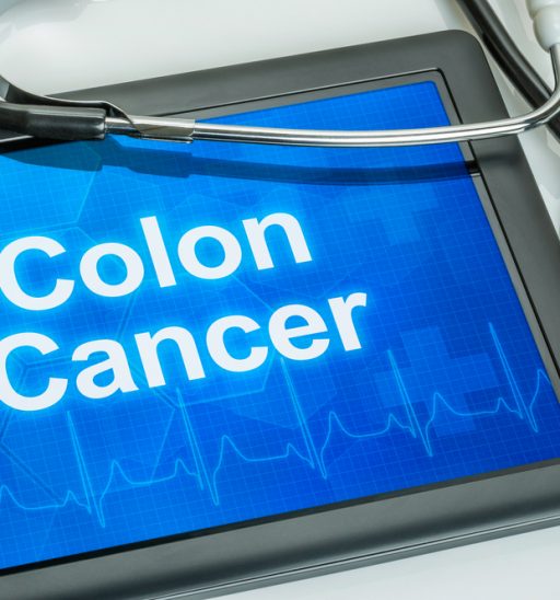 Colon Cancer Diagnosis - Tennessee Cancer Specialists